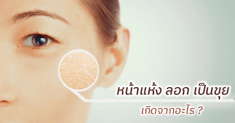 หน้าลอกเกิดจากอะไร รู้สาเหตุและวิธีดูแลผิวแห้ง ลอกเป็นขุย