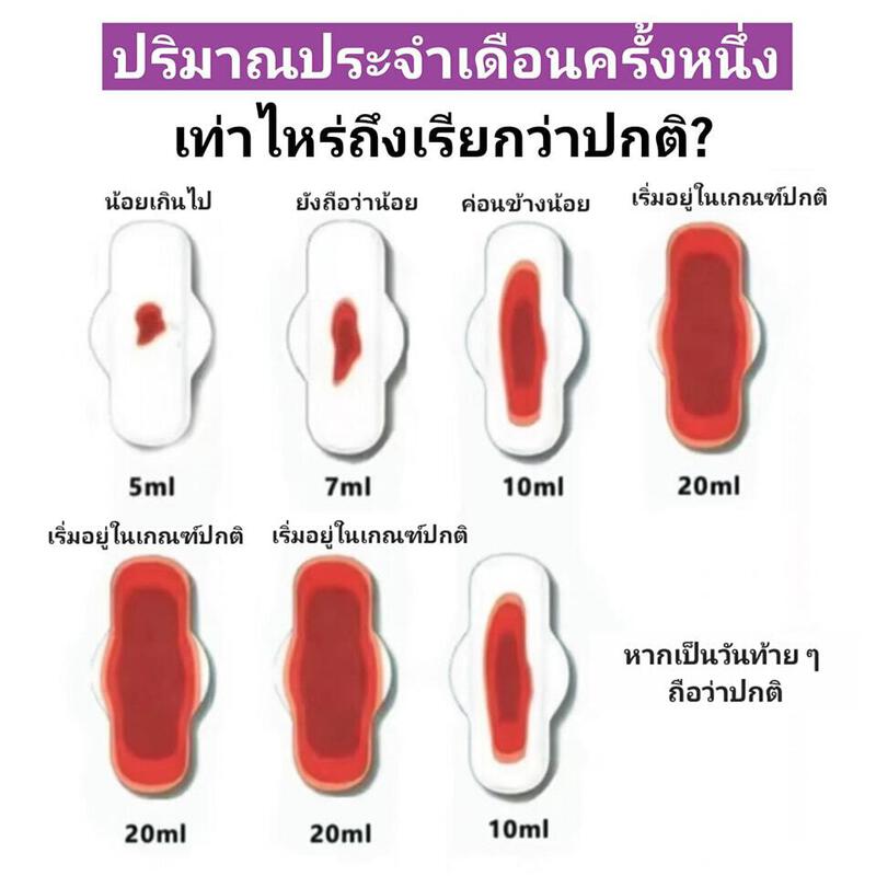 ไม่มีคำอธิบายรูปภาพ